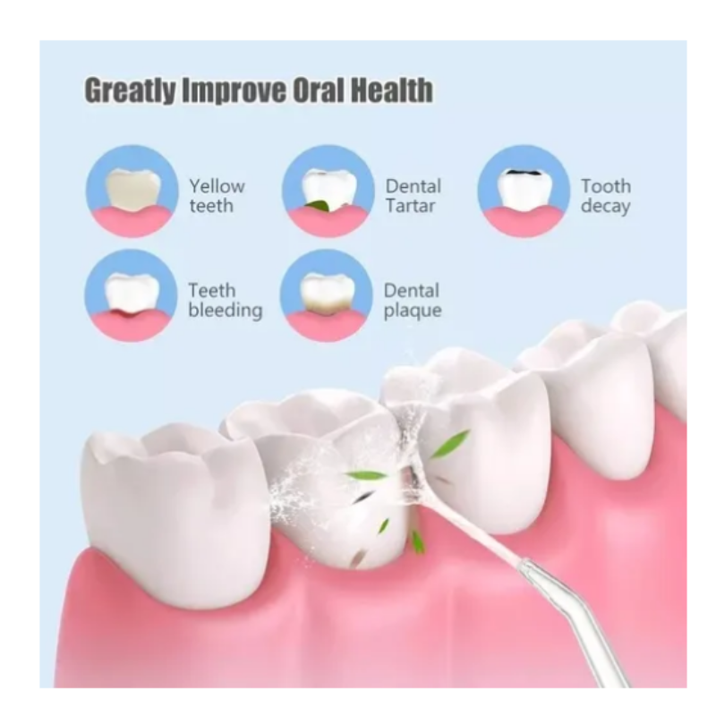 Irrigador Bucal Portátil Recargable 4 Boquillas | Limpieza Dental Profunda Profesional Sin Dolor - Image 6